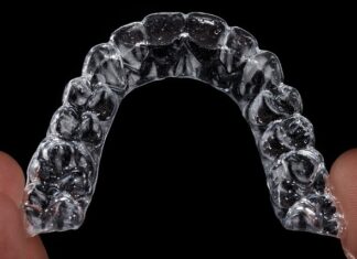 Ile kosztują nakładki Invisalign?